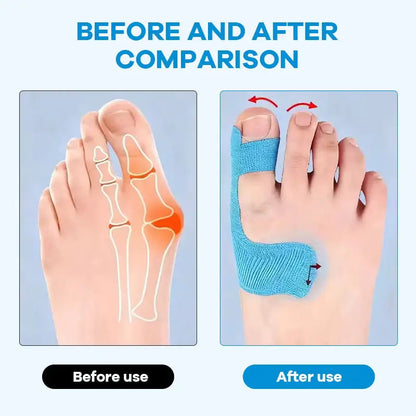 60Pcs Pre‑Cut Bunion Support Kinesiology Tape